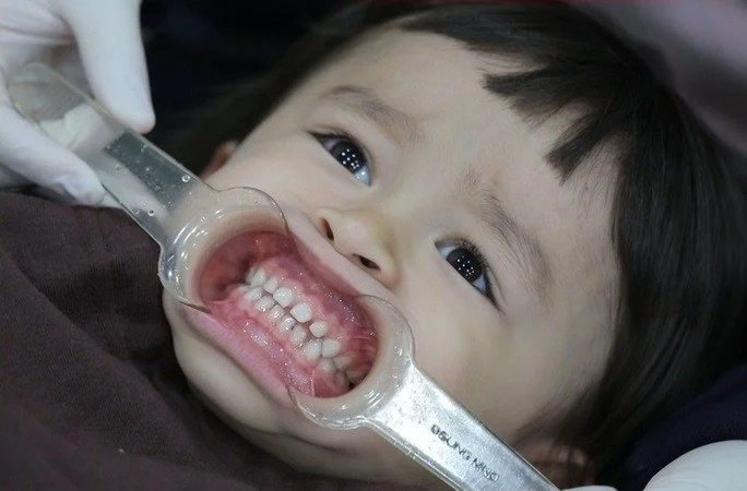 可爱又搞怪的可爱萌娃微信头像